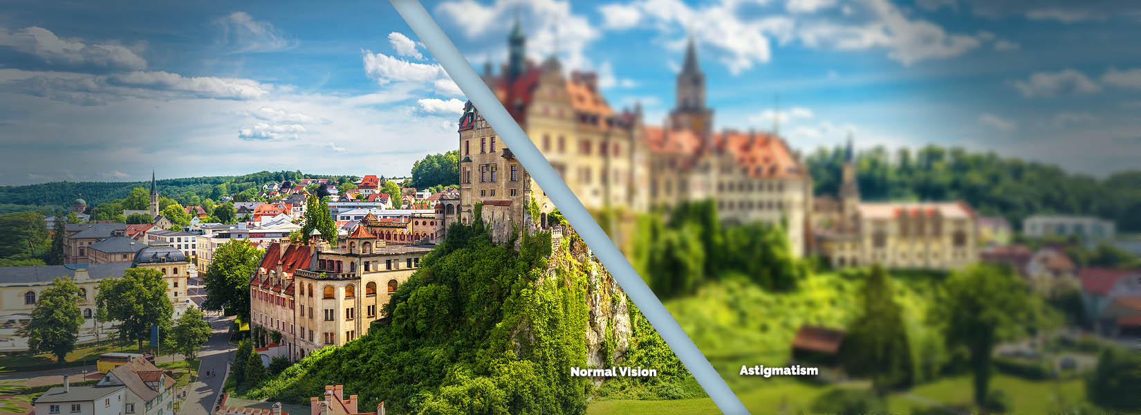 Astigmatism Treatment in Lexington